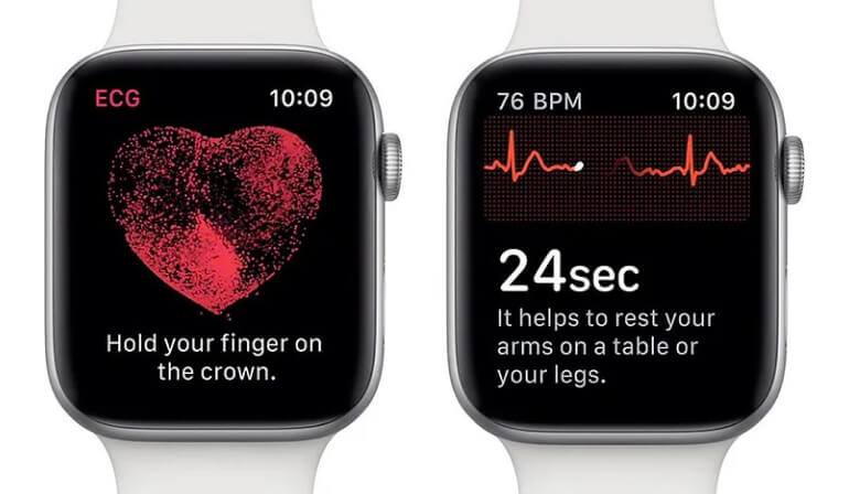 The Apple Watch ECG function: some thoughts